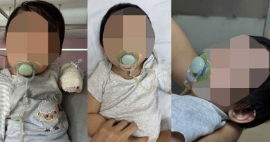 才送去照顾3天 华裔女婴受伤 警方扣查保母