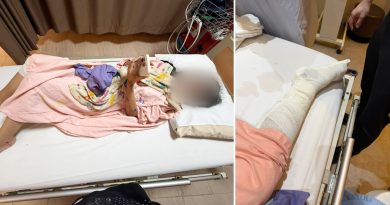 轿车撞后逃 华裔少女脚踝骨裂